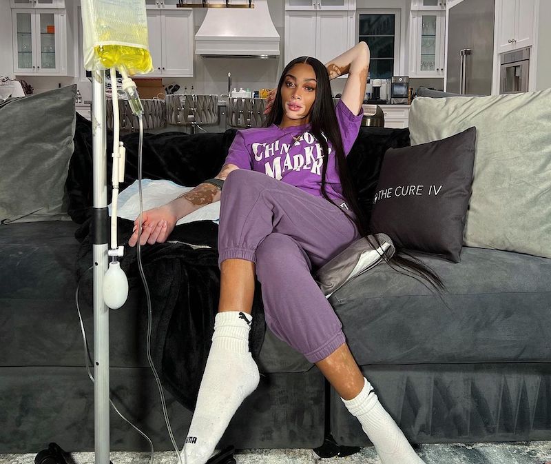 Winnie Harlow | I was never raised as the daughter with vitiligo